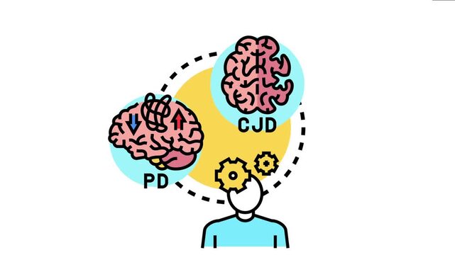 Prion disorder causing neurodegenerative disease affecting the human brain, mental health problems and different types of neurological conditions like cjd and pd