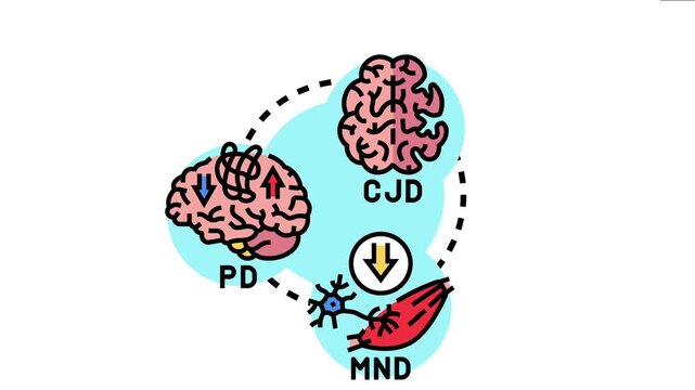 Prion induced neurodegeneration concept various disease states like creutzfeldt jakob, parkinson's, and motor neuron diseases affecting brain and nerve function