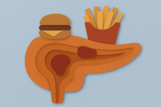 Layered paper pancreas with fast food burger and fries, depicting diet impact on organ health, insulin resistance concept on blue background