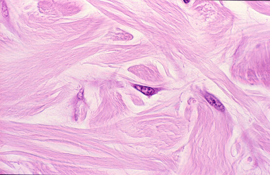 Connective tissue fibroblasts