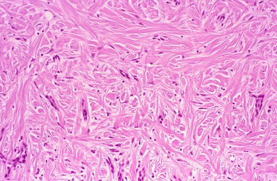 Dense or fibrous connective tissue