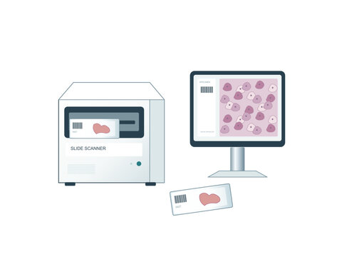 Digital pathology slide scanner with tissue image on monitor