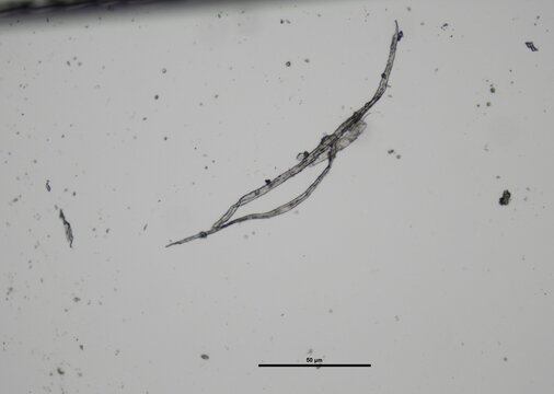 soil microorganisms under a microscope including amoeba, flagellates, nematodes, fungi, bacteria