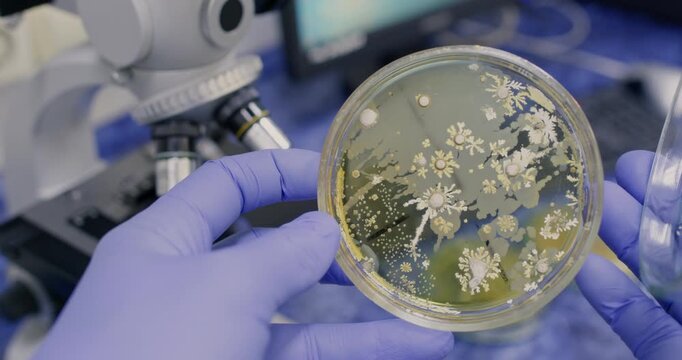 Bacterial colonies resembling tiny jellyfish in a Petri dish, held by a scientist next to a microscope. Laboratory research on bacteria.
