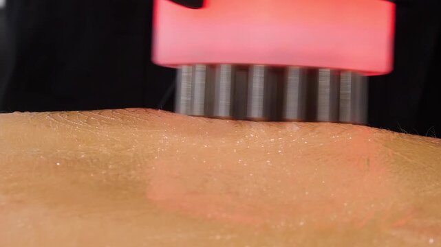 Professional body shaping therapy with vibromassage thermo vacuum and bioelectrical stimulation in beauty salon. 