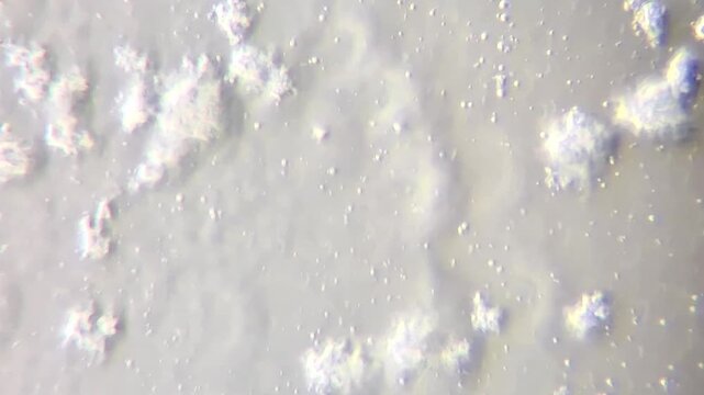 Microscopic view of cottage cheese curd particles and whey structure