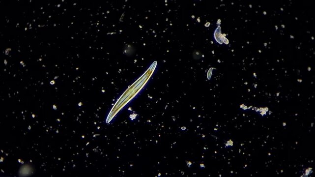 Microscopic view of a diatom microalga moving in aquatic environment, darkfield illumination 4k