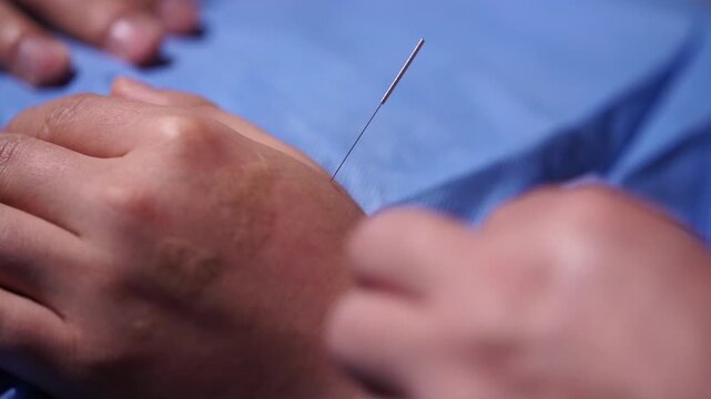 Acupuncture Moxibustion Oriental Medicine Korean Medicine Doctor Patient Treatment Therapy Clinic Korea 침 뜸 한의학 한의사 한의원 진료 치료 침술 뜸치료 혈자리 동의보감 한국