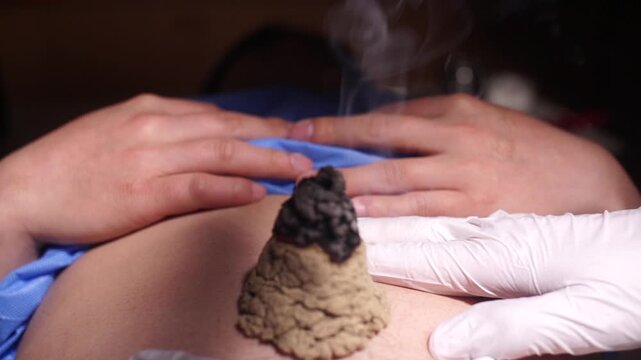 Acupuncture Moxibustion Oriental Medicine Korean Medicine Doctor Patient Treatment Therapy Clinic Korea 침 뜸 한의학 한의사 한의원 진료 치료 침술 뜸치료 혈자리 동의보감 한국