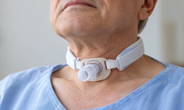 patient wears a tracheostomy tube in a clinical closeup