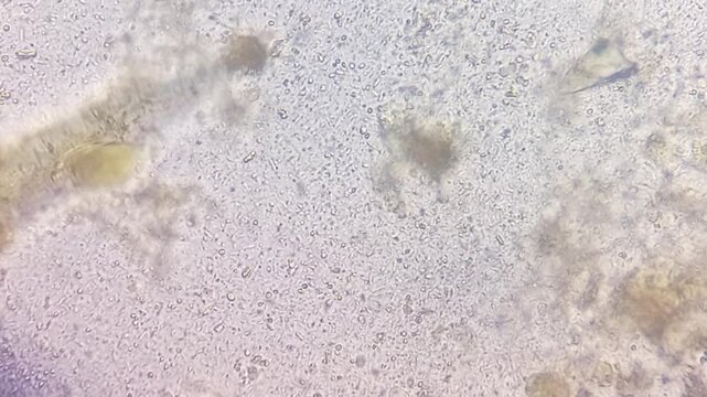 Microscopic footage of human feces or stool showing bacteria. Bacteria in stool. 