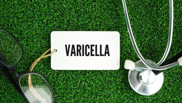 Stethoscope, glasses and a paper tag with the word Varicella, commonly known as chickenpox, is a highly contagious, vaccine-preventable disease caused by the varicella-zoster virus