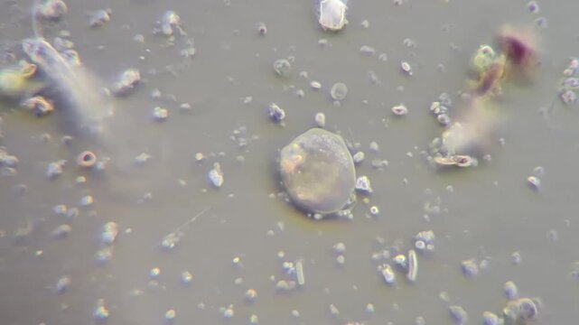 Timelapse of a microscopic amoeba moving and changing shape