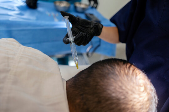 Professional injecting treatment into patient's scalp for hair growth