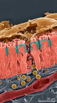 Stomach epithelial cells showing gastric mucosa damage, ethanol molecules diffusing through broken tight junctions, eroded protective lining, gastrointestinal pathophysiology.