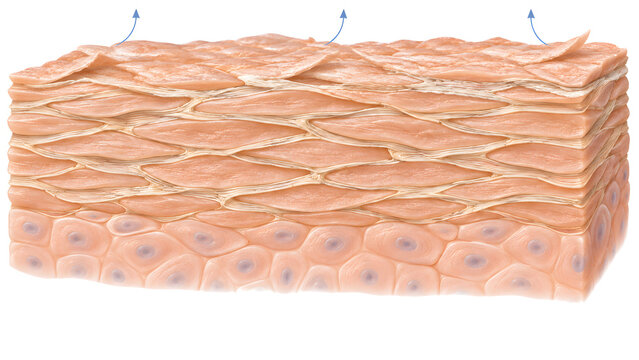 Dry Skin Barrier with Superficial Flaking and Increased Water Loss