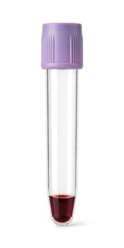 Medical blood collection tube with purple cap and small amount of blood sample isolated on white background