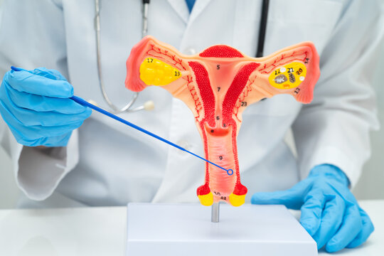 Doctor holding human uterus model for vaginal and cervix pap smear check up in the obstetrics and gynecology.