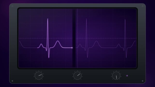Heartbeat ecg line pulsing in violet across a dark medical monitor screen with control buttons