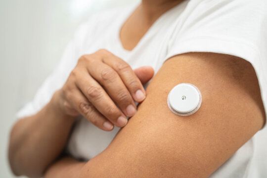 Asian woman with CGM continuous glucose sensor measuring blood sugar level patch for diabetes management.