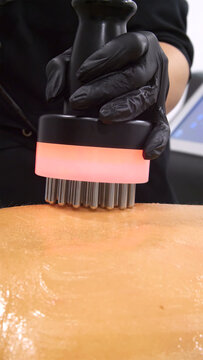 Professional body shaping therapy with vibromassage thermo vacuum and bioelectrical stimulation in beauty salon. 